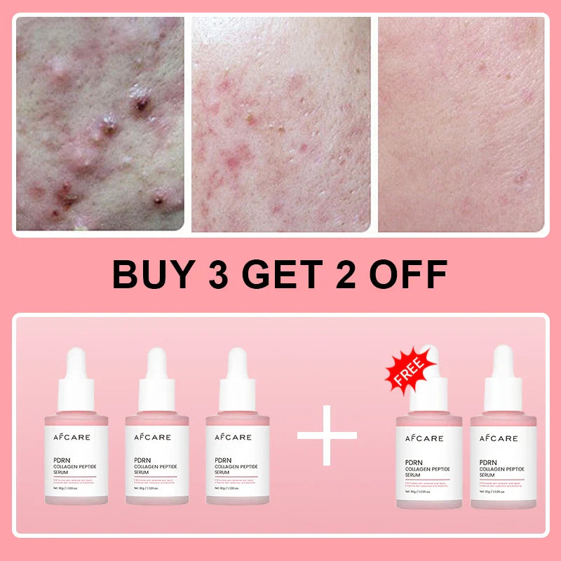 Collagen Peptide Facial Serum Targets Dull Skin Boosts Skin Elasticity Stimulates Skin Renewal Repair Salmon PDRN KOREAN Product